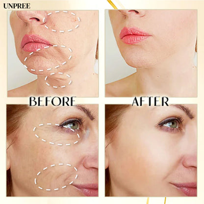 Unpree™ Water Soluble Collagen Film Patches