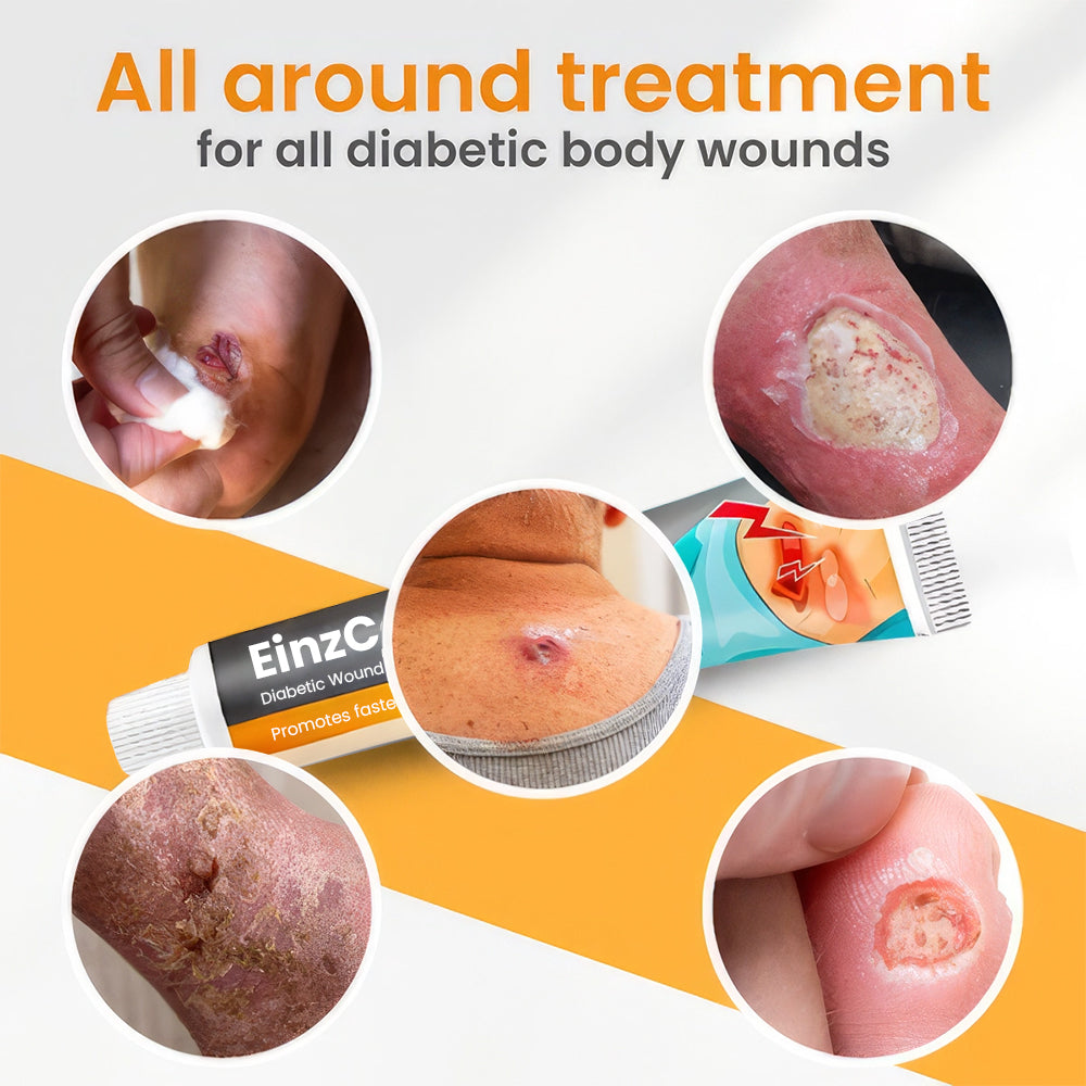 EinzCare™ Diabetic Wounds Treatment Cream -  Recommended by Experts! 🔥 80% Limited Discounts! 💰