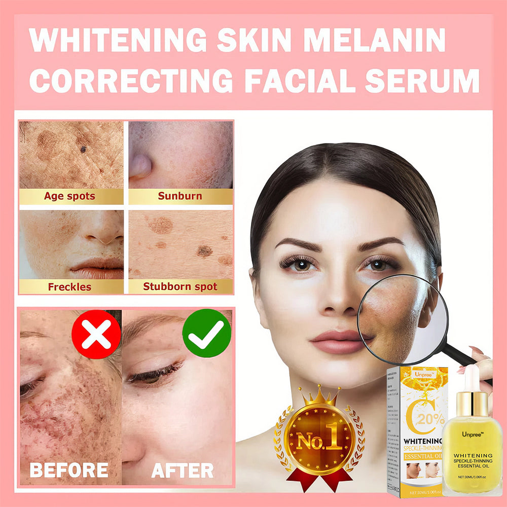 Unpree™ Whitening Skin Melanin Correcting Facial Serum